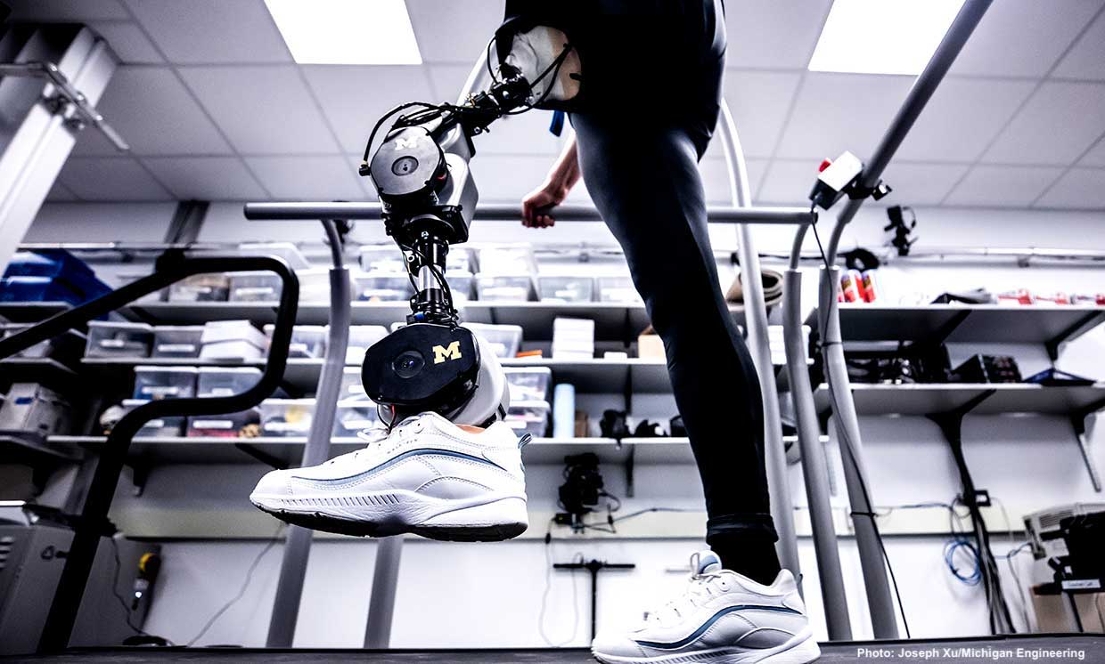 An Open-Source Bionic Leg